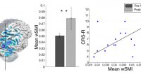 15年間植物状態だった患者、最新の治療で最小意識状態まで回復に成功