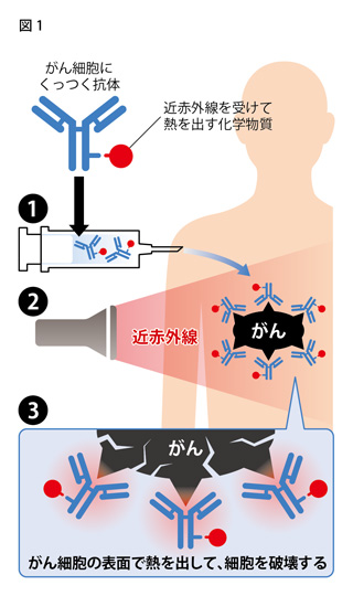 近赤外線を使った新しいがん治療法のイメージ