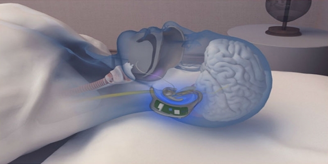 いびきで困っている人を助けるイヤホン型ガジェット「Snore Circle」の便利さ