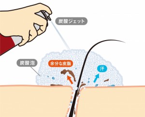 スカルプＤ モーニング炭酸ジェットスカルプシャンプー